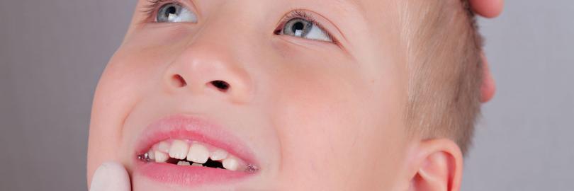 Kinderzähne